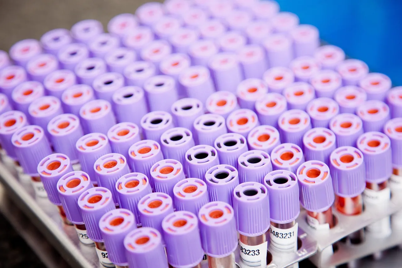 Laboratory, samples, tubes